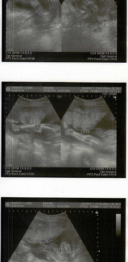 We’re having a….. (wordless wednesday)